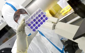 French engineer-virologist Thomas Mollet looks at 24 well plates adherent cells monolayer infected with a Sars-CoV-2 virus at the Biosafety level 3 laboratory (BSL3) of the Valneva SE Group headquarters in Saint-Herblain, near Nantes, western France, on July 30, 2020. - Could the Covid-19 vaccine be found by a biotechnology company in western France, far from major global research centers? The hypothesis is more than plausible for the British government, which has just signed an important agreement with it. (Photo by JEAN-FRANCOIS MONIER / AFP) (Photo by JEAN-FRANCOIS MONIER/AFP via Getty Images)