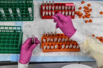 Vaccino Coroanvirus, Mantoan (Aifa): “Può arrivare a inizio 2021”