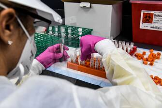 A lab technician sorts blood samples inside a lab for a COVID-19 vaccine study at the Research Centers of America (RCA) in Hollywood, Florida, on August 13, 2020. - So-called phase three vaccine clinical trials, in which thousands of people take part in the final stages, are gaining traction in Florida. With more than half a million cases and over 9,000 deaths, Florida ranks second in the US in total cases behind California, making it an ideal place to carry out the trials. That has led to a flurry of activity at the RCA, a private center carrying out clinical trials in Hollywood, 25 miles (40kms) north of Miami. (Photo by CHANDAN KHANNA / AFP) (Photo by CHANDAN KHANNA/AFP via Getty Images)