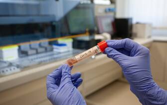 vaccino coronavirus