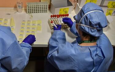 Preparativi per i test sierologici al laboratorio di microbiologia dell ospedale - Iniziati all ospedale di Cremona i prelievi ematici per i test sierologici per verificare la presenza degli anticorpi per l emergenza epidemia coronavirus Covid-19, Cremona 23 Aprile 2020Ansa/Matteo Corner