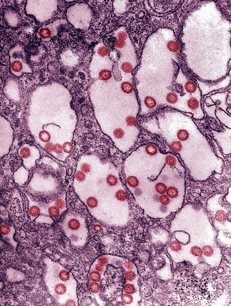 Electron Micrograph Of The Rift Valley Fever Virus. Rift Valley Fever Rvf Virus Is A Member Of The Genus Phlebovirus In The Family Bunyaviridae, First Reported In Livestock In Kenya Around 1900. (Photo By BSIP/UIG Via Getty Images)
