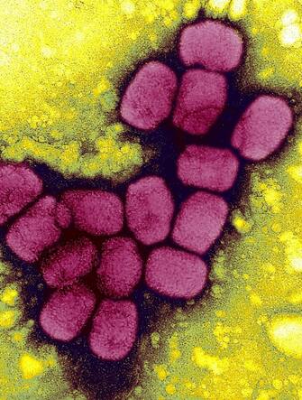 Smallpox Virus. A Transmission Electron Micrograph Of Smallpox Viruses Using A Negative Stain Technique. Smallpox Is A Serious, Highly Contagious, And Sometimes Fatal Infectious Disease. There Is No Specific Treatment For Smallpox Disease, And The Only Prevention Is Vaccination. (Photo By BSIP/UIG Via Getty Images)