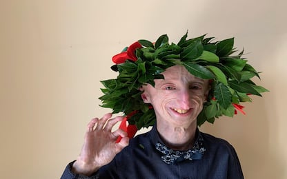 Progeria, Sammy Basso si è laureato per la seconda volta