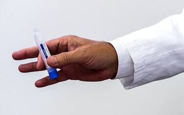 Covid, via libera del ministero al test salivare: ecco le linee guida