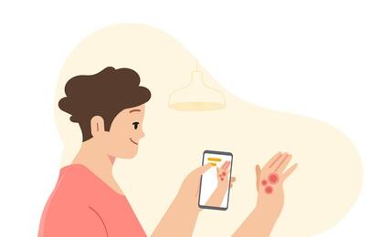 Google: nuovo strumento per individuare malattie pelle da foto utenti