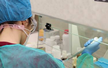 Individuato nelle scimmie gene che intrappola virus come Hiv e Ebola
