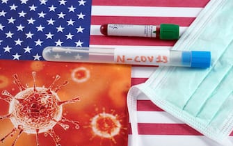 Milano - Tampone e analisi del sangue - Diffusione della pandemia di Coronavirus n-CoV 2019 - Francia, Spagna, Italia, Europa e America colpiti dall'epidemia