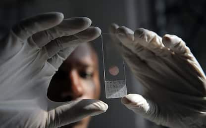 L'Oms raccomanda il primo vaccino contro la malaria per i bambini