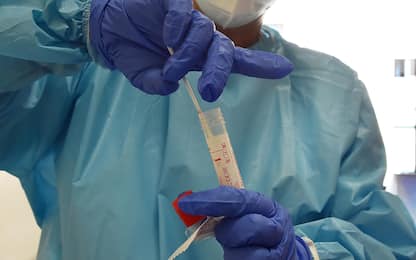 Test riservati a sintomatici, in Veneto centri tampone chiusi a no vax