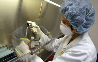 Assistant Scientist Sigrun Haugerud demonstrates how to prepare a test sample, the first step taken when testing for the monkeypox virus at the University of Minnesota's Veterinary Diagnostic Laboratory. At this point the sample is rendered noninfectious. The sample is then moved to another lab for DNA extraction, then to another lab (all in the same building)  to have the DNA tested for the presence of the monkeypox virus. The site has been chose by the Center For Disease Control as the national testing site for the virus. At present, the laboratory is preparing the test, using the same state of the art molecular technology as the CDC labs. 
GENERAL INFORMATION: 7/31/03- Falcon Heights, MN - The University of Minnesota's Veterinary Disease Control Laboratory has been chosen by the Center For Disease Control as the national testing site to screen for the monkeypox virus in animals.