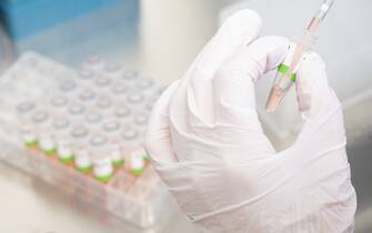1237545907 05 January 2022, Lower Saxony, Hanover: A biological-technical assistant prepares PCR tests for the Corona virus from patients in the PCR laboratory of the Lower Saxony State Health Office (NLGA) for analysis. Photo: Julian Stratenschulte/dpa (Photo by Julian Stratenschulte/picture alliance via Getty Images)