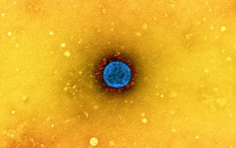 Transmission electron micrograph of a SARS-CoV-2 virus particle (UK B.1.1.7 variant), isolated from a patient sample and cultivated in cell culture. The prominent projections (red) seen on the outside of the virus particle (blue) are spike proteins. This fringe of proteins enables the virus to attach to and infect host cells and then replicate. Image captured at the NIAID Integrated Research Facility (IRF) in Fort Detrick, Maryland.
