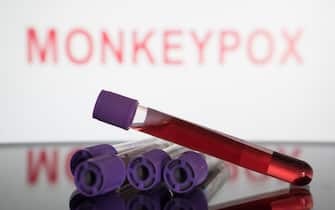 In this photo illustration,  blood test vials are seen in front of a screen that says ''Monkeypox'' (Photo illustration by Nikos Pekiaridis/NurPhoto via Getty Images)