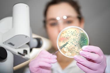 Researcher working in microbiology laboratory with bacterial culture plate