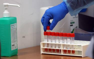 Covid in Italia e nel mondo, ultime notizie di oggi 13 gennaio 