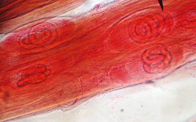 Larve di Trichinella spiralis all'interno di un muscolo