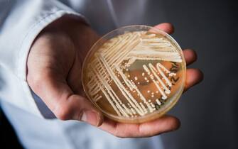 The director of the National Reference Centre for Invasive Fungus Infections, Oliver Kurzai, holding in his hands a petri dish holding the yeast candida auris in a laboratory of Wuerzburg University in Wuerzburg, Germany, 23 January 2018. There has been a recent rise of cases in Germany of seriously ill patients becoming infected with the dangerous yeast candida auris. Photo: Nicolas Armer/dpa (Photo by Nicolas Armer/picture alliance via Getty Images)