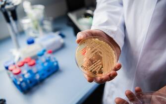 984938380 The director of the National Reference Centre for Invasive Fungus Infections, Oliver Kurzai, holding in his hands a petri dish holding the yeast candida auris in a laboratory of Wuerzburg University in Wuerzburg, Germany, 23 January 2018. There has been a recent rise of cases in Germany of seriously ill patients becoming infected with the dangerous yeast candida auris. Photo: Nicolas Armer/dpa (Photo by Nicolas Armer/picture alliance via Getty Images)