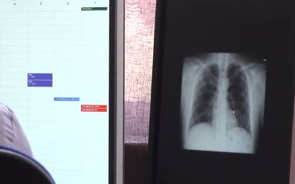 Covid, a Torino un algoritmo fa la diagnosi via radiografia