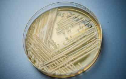 Candida Auris in Italia, morto un uomo a Milano dopo rientro da Grecia
