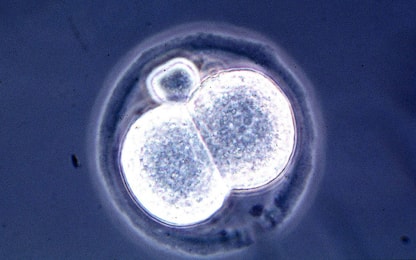 Ottenuti embrioni umani sintetici con cellule staminali