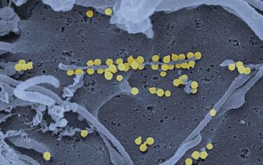 Scanning electron micrograph of Crimean-Congo hemorrhagic fever (CCHF) viral particles (yellow) budding from the surface of cultured epithelial cells from a patient. (Photo by: IMAGE POINT FR/NIH/NIAID/Universal Images Group via Getty Images)