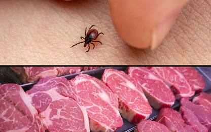 Sindrome alfa-gal, allergia alla carne rossa causata da morso di zecca