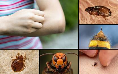 Punture di insetti, come riconoscerle e cosa fare