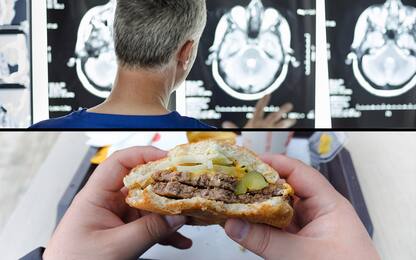 Salute, junk food altera l'area del cervello che controlla la fame