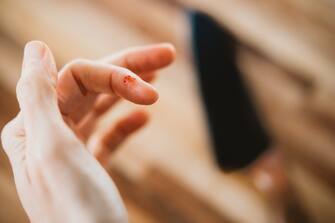 1292119183 Most common kitchen accidents