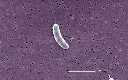 Vibrio Vulnificus, il batterio mangia carne preoccupa gli Usa