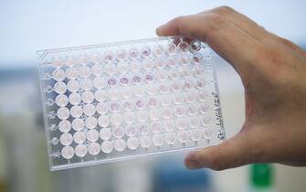 Laboratory developing therapeutic vaccines for the treatment of lung cancer by stimulating the immune system.