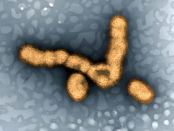 Influenza suina, certificato il primo contagio umano nel Regno Unito