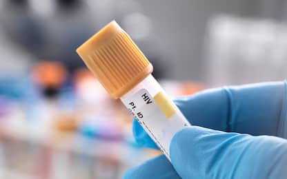 HIV eliminato dalle cellule infette con l'editing genetico: lo studio