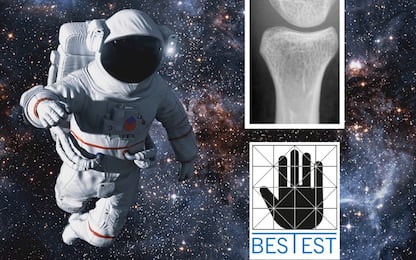 Fragilità ossea: la tecnologia Bes Test ambisce ad andare nello spazio
