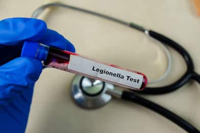  Legionella, i sintomi e gli ambienti a rischio
