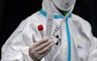A hospital employee wearing protection mask and gear shows a swab, a cotton wab for taking mouth specimen, used at a temporary emergency structure set up outside the accident and emergency department, where any new arrivals presenting suspect new coronavirus symptoms will be tested, at the Brescia hospital, Lombardy, on March 13, 2020. (Photo by Miguel MEDINA / AFP) (Photo by MIGUEL MEDINA/AFP via Getty Images)