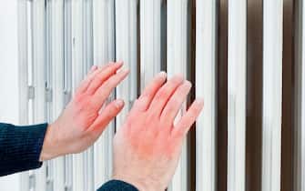 Chapped hands warming next to an home radiator