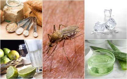 Punture di zanzara, cinque rimedi naturali contro il prurito