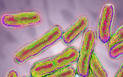 Richiamato lotto di salsiccia Bartoloni, rischio salmonella