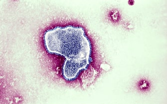 Thic Electron Micrograph Reveals The Morphologic Traits Of The Respiratory Syncytial Virus Rsv. The Virion Is Variable In Shape, And Size Average Diameter Of Between 120 300Nm. Rsv Is The Most Common Cause Of Bronchiolitis And Pneumonia Among Infants And Children Under 1 Year Of Age. (Photo By BSIP/UIG Via Getty Images)