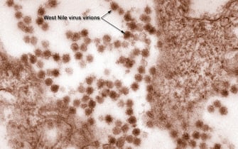epa03367653 A handout image made available on 22 August 2012 from the Centers for Disease Control showing a transmission electron micrograph (TEM) revealing the presence of West Nile virus virions in a tissue sample.  Experts believe WNV is established as a seasonal epidemic in North America that flares up in the summer and continues into the fall. This fact sheet contains important information that can help you recognize and prevent West Nile virus. The CDC is reporting that there have currently been 1,100 cases of West Nile Virus reported in the US in 2012, more than ever reported at this point in the year since the virus was first recorded in the US in 1999.  EPA/CYNTHIA GOLDSMITH / CENTERS FOR DISEASE CONTROL / HANDOUT  HANDOUT EDITORIAL USE ONLY/NO SALES