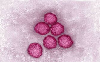 Flavivirus (family Flaviviridae), these viruses are responsible for yellow fever, dengue fever, Japanese encephalitis, Zika virus, West Nile encephalitis. They are transmitted by mosquitoes or ticks. image produced from transmission electron microscopy (viral diameter approximately 40 to 60 nm). (Photo by: CAVALLINI JAMES/BSIP/Universal Images Group via Getty Images)
