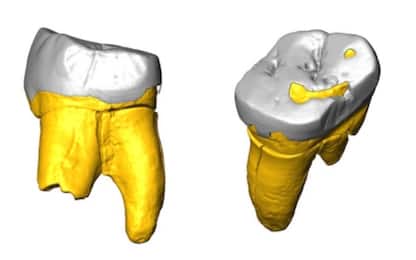 Scoperte in un dente tracce di Dna di un Neanderthal di 80mila anni fa