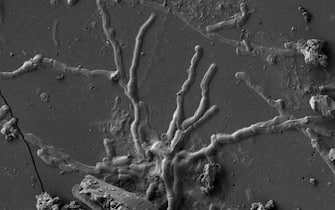 neuroni pompei