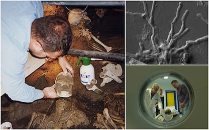 Pompei, neuroni integri scoperti in vittima dell'eruzione.  FOTO