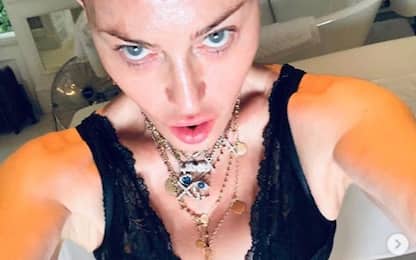 Madonna annuncia su Instagram un'operazione al ginocchio e  all'anca