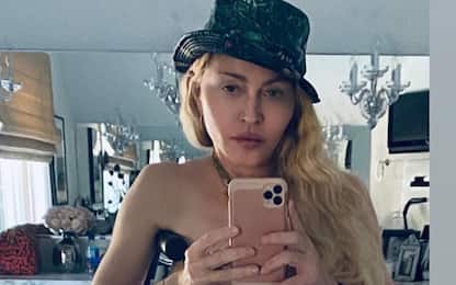 Madonna: selfie in topless con stampella su Instagram