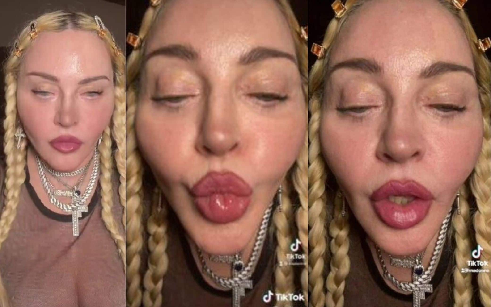 Madonna irriconoscibile su Tiktok: colpa di un filtro o del lifting? La